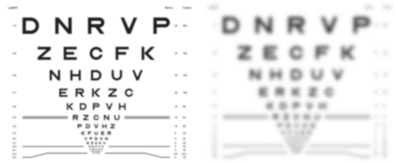 An eye chart viewed with refractive error of -2 dioptres but different pupil diameters